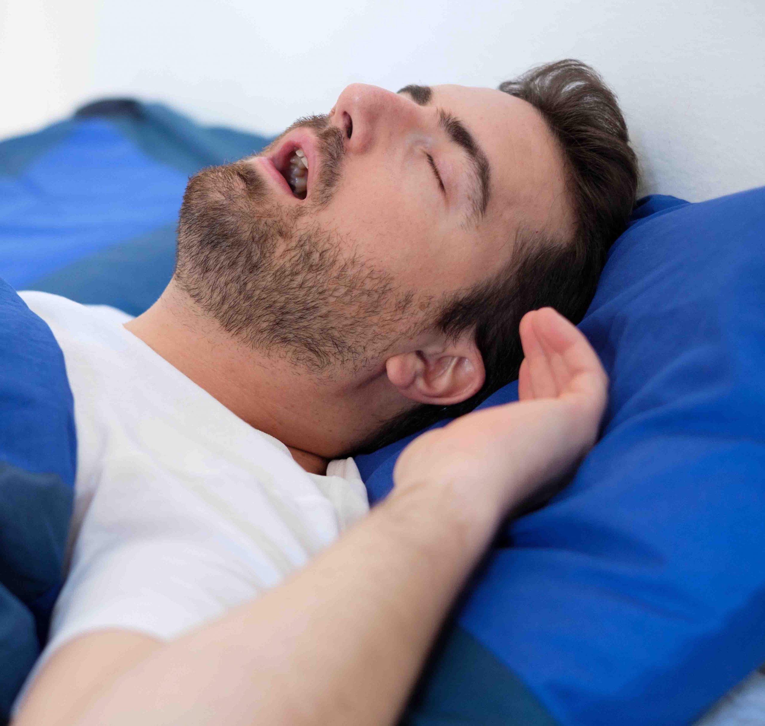 Ronquido y apnea del sueño